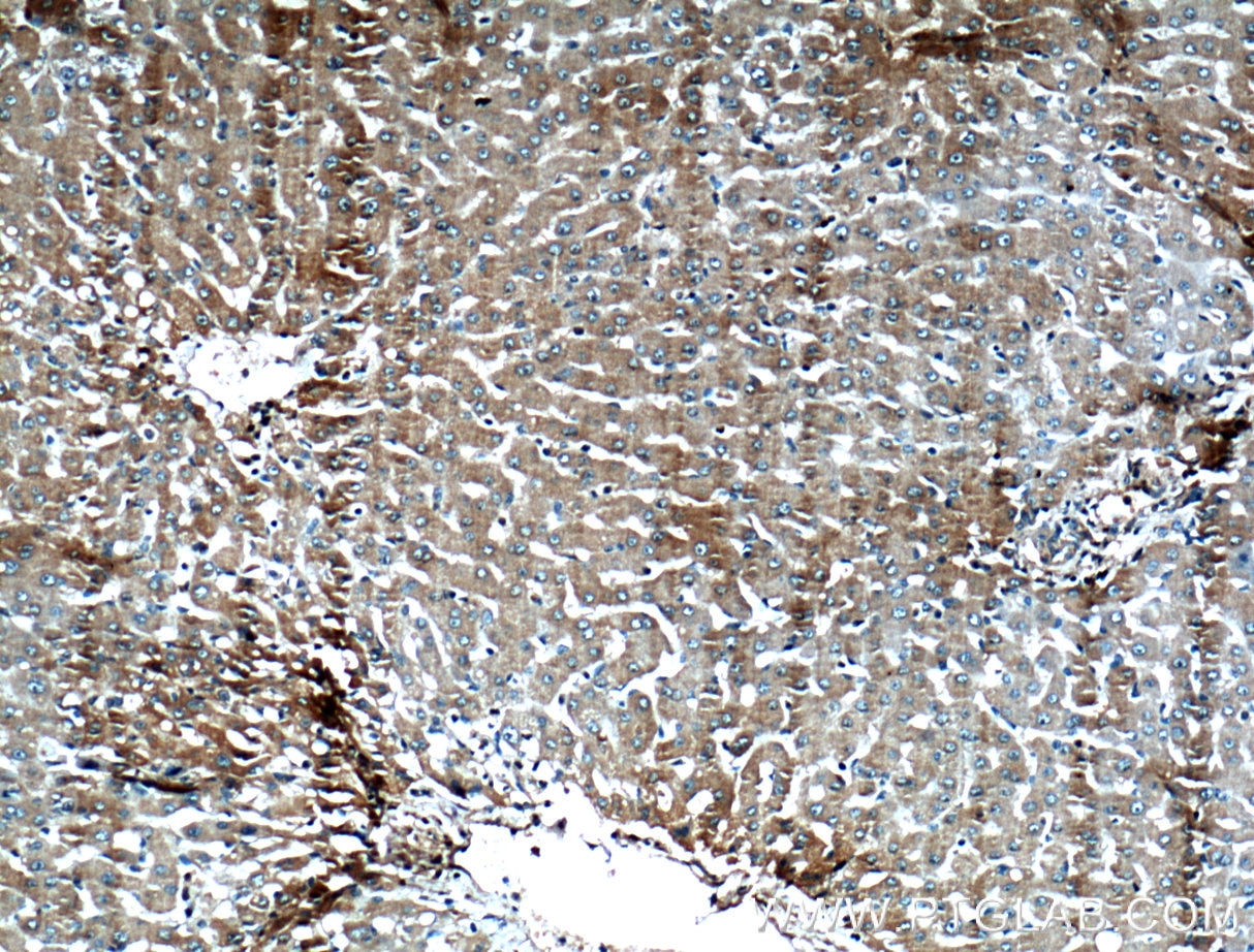 Immunohistochemistry (IHC) staining of human liver tissue using VDAC2 Monoclonal antibody (66388-1-Ig)