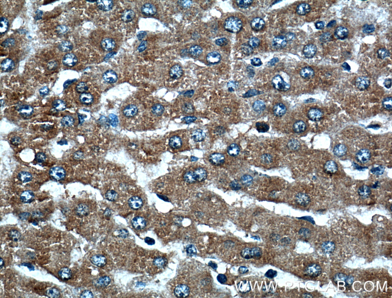 IHC staining of human liver using 66388-1-Ig