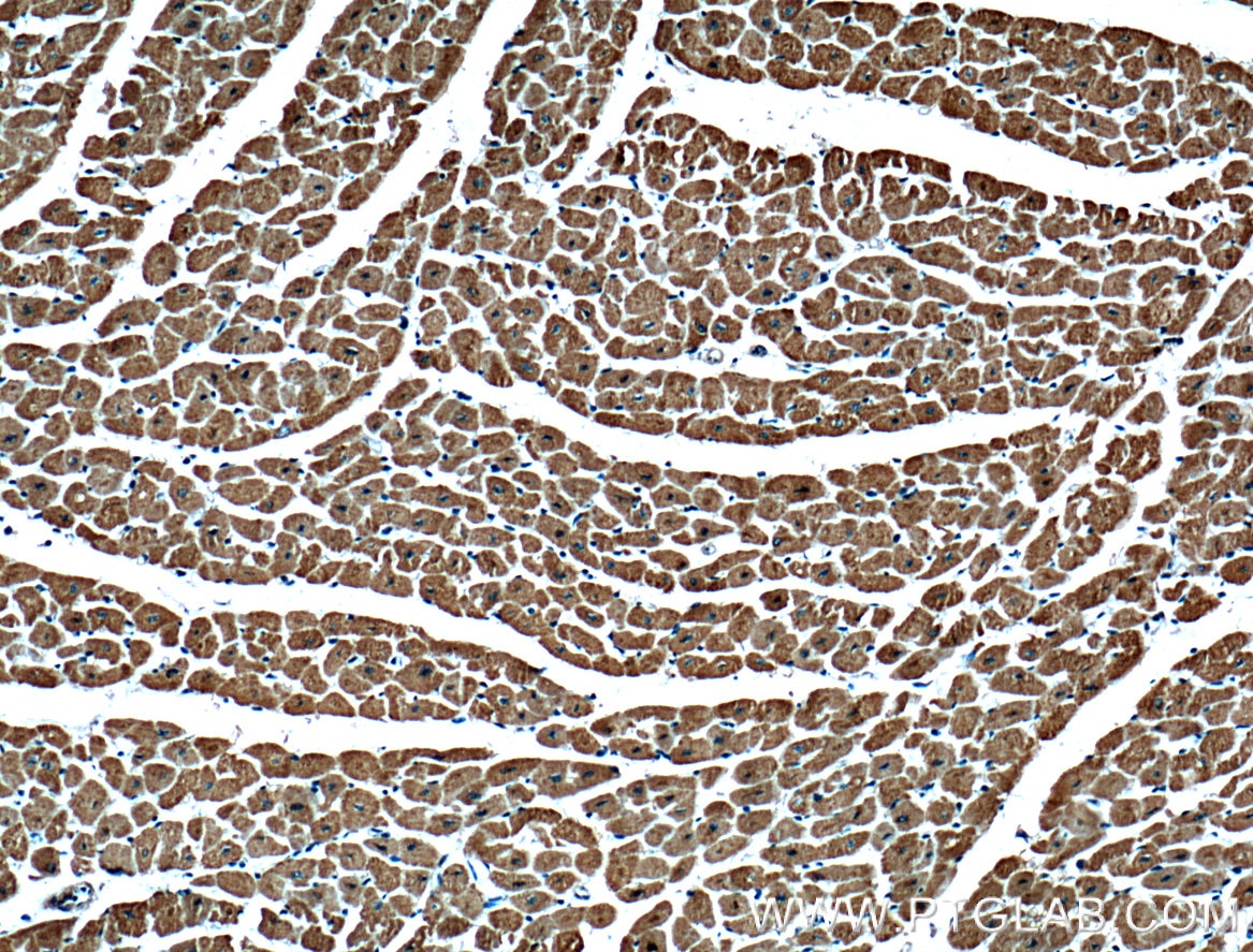 Immunohistochemistry (IHC) staining of human heart tissue using VDAC2 Monoclonal antibody (66388-1-Ig)