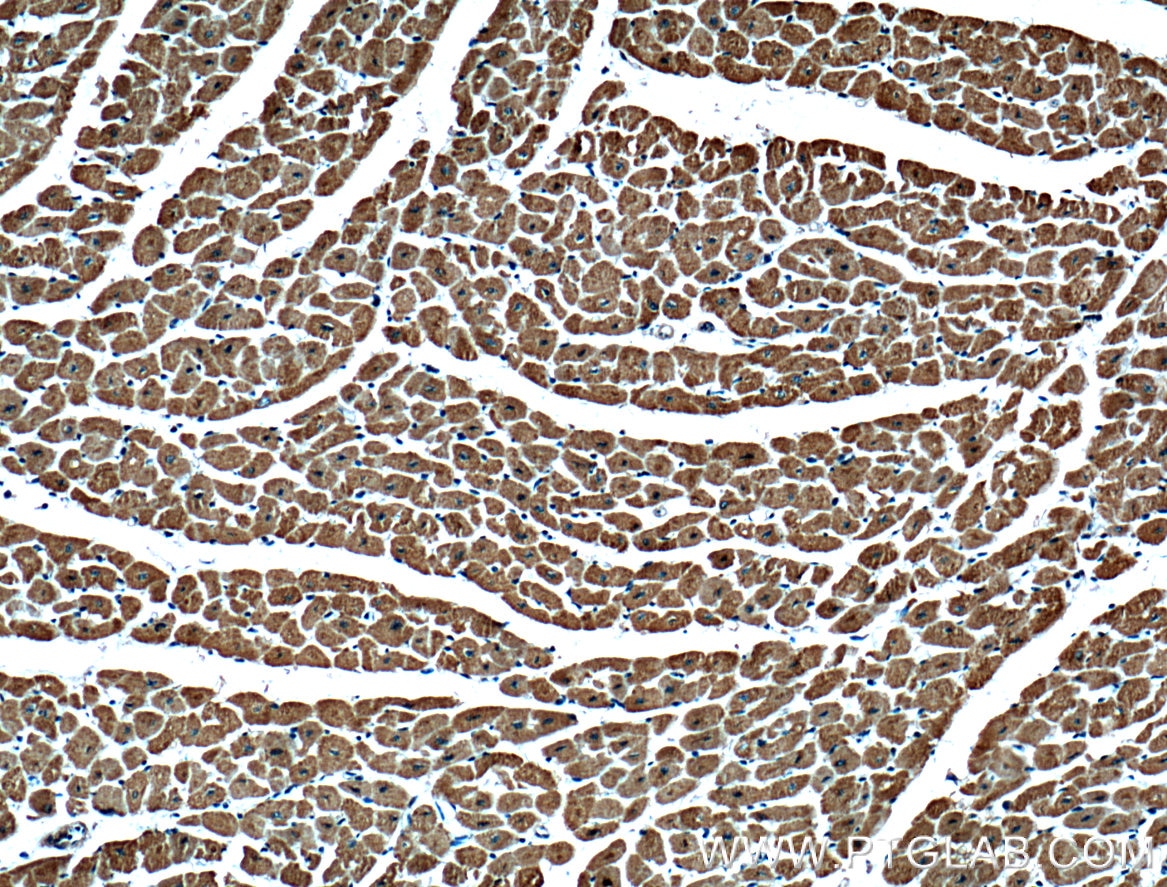 IHC staining of human heart using 66388-1-Ig