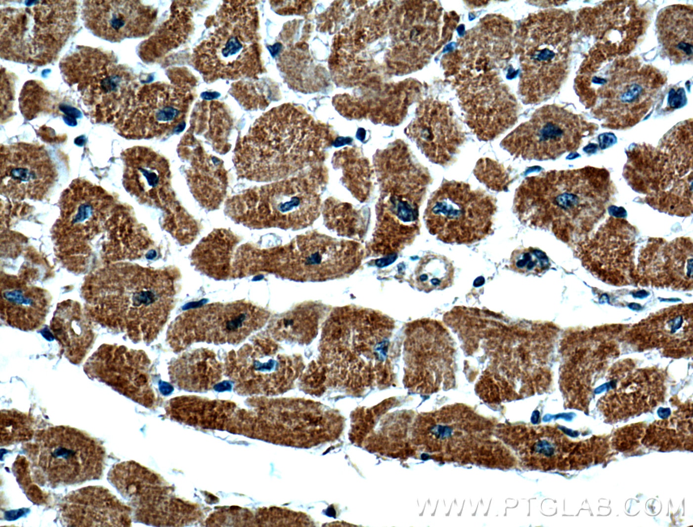 Immunohistochemistry (IHC) staining of human heart tissue using VDAC2 Monoclonal antibody (66388-1-Ig)