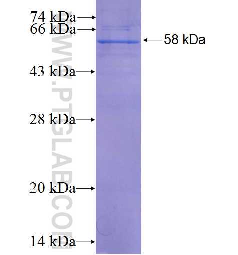 VDAC2 fusion protein Ag2266 SDS-PAGE