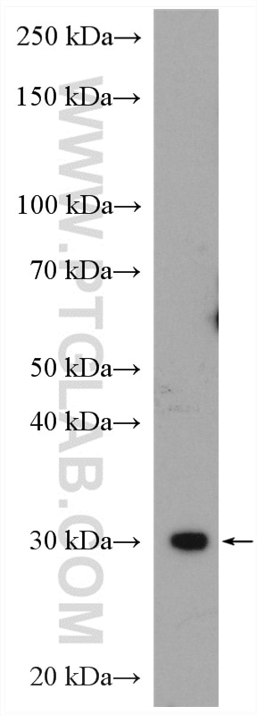 Western Blot (WB) analysis of mouse brain tissue using VDAC3 Polyclonal antibody (14451-1-AP)