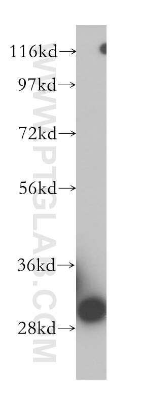 Western Blot (WB) analysis of human brain tissue using VDAC3 Polyclonal antibody (14451-1-AP)