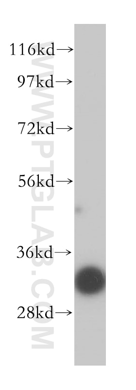 Western Blot (WB) analysis of human heart tissue using VDAC3 Polyclonal antibody (14451-1-AP)