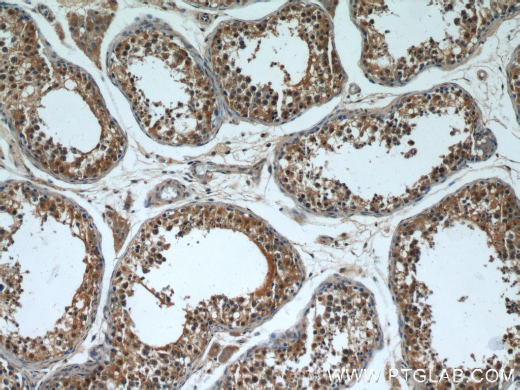 Immunohistochemistry (IHC) staining of human testis tissue using VDAC3 Polyclonal antibody (55260-1-AP)