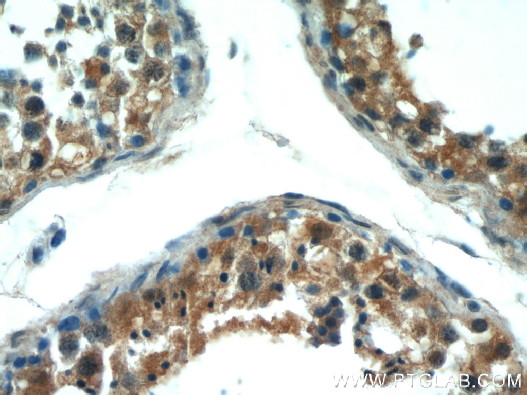 IHC staining of human testis using 55260-1-AP