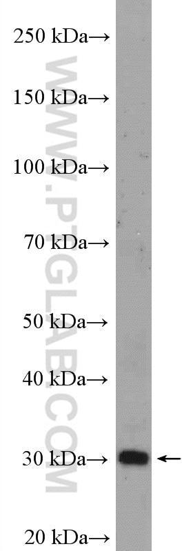 Western Blot (WB) analysis of A431 cells using VDAC3 Polyclonal antibody (55260-1-AP)