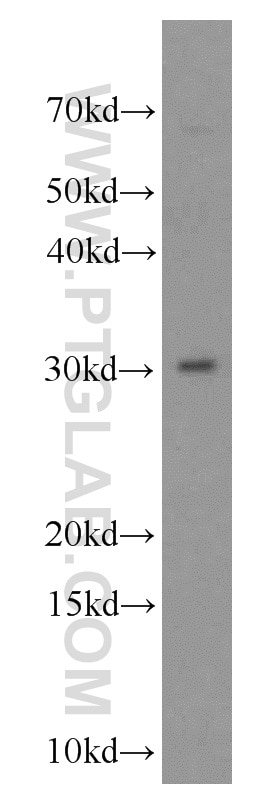 Western Blot (WB) analysis of mouse testis tissue using VDAC3 Polyclonal antibody (55260-1-AP)