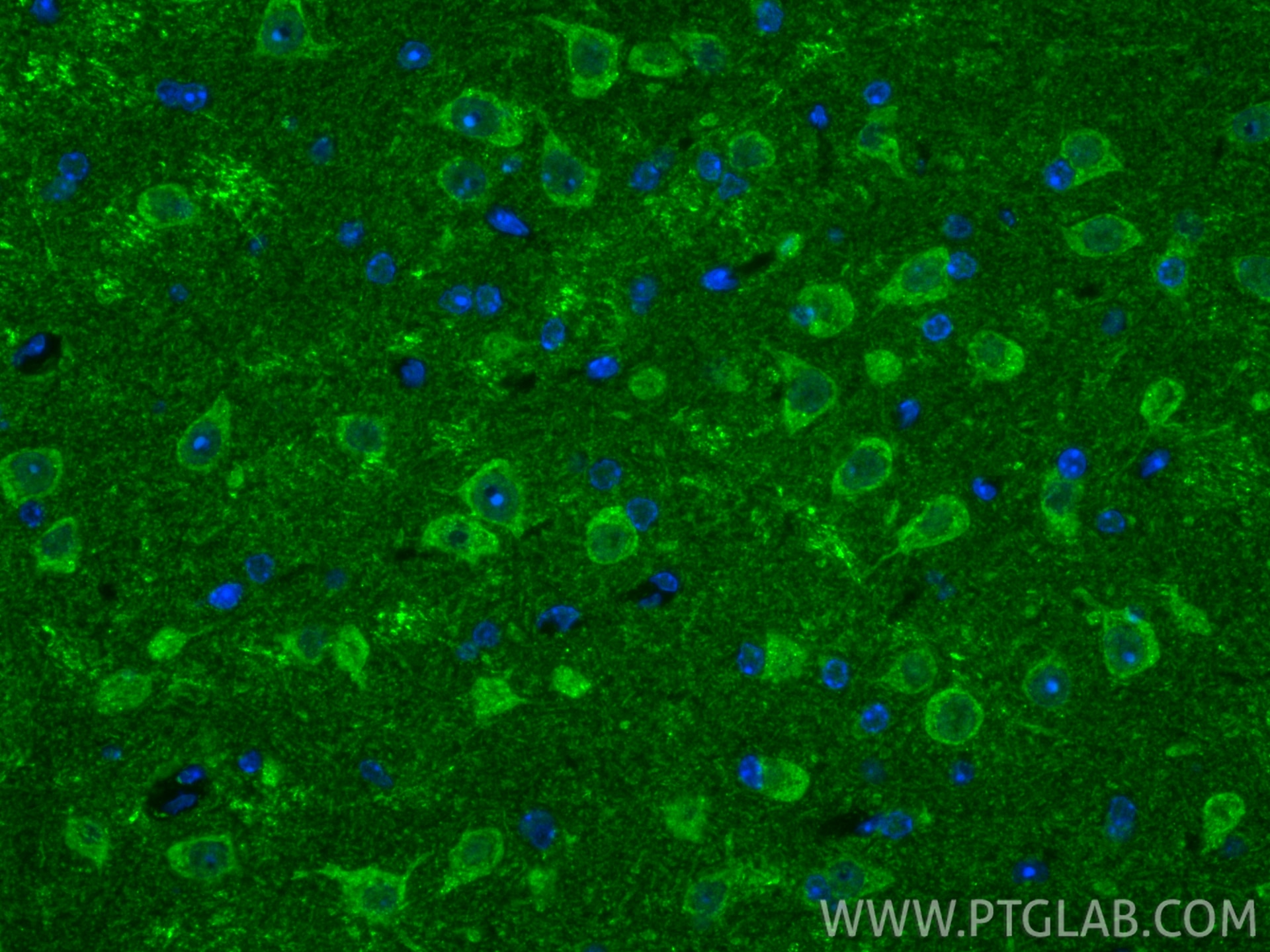 Immunofluorescence (IF) / fluorescent staining of mouse brain tissue using Multi-rAb® VDAC3 Multi-Recombinant antibody (RMX00001)