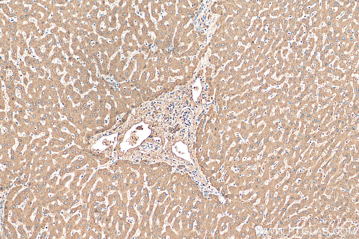 Immunohistochemistry (IHC) staining of human liver tissue using Vitamin D binding protein Polyclonal antibody (16922-1-AP)