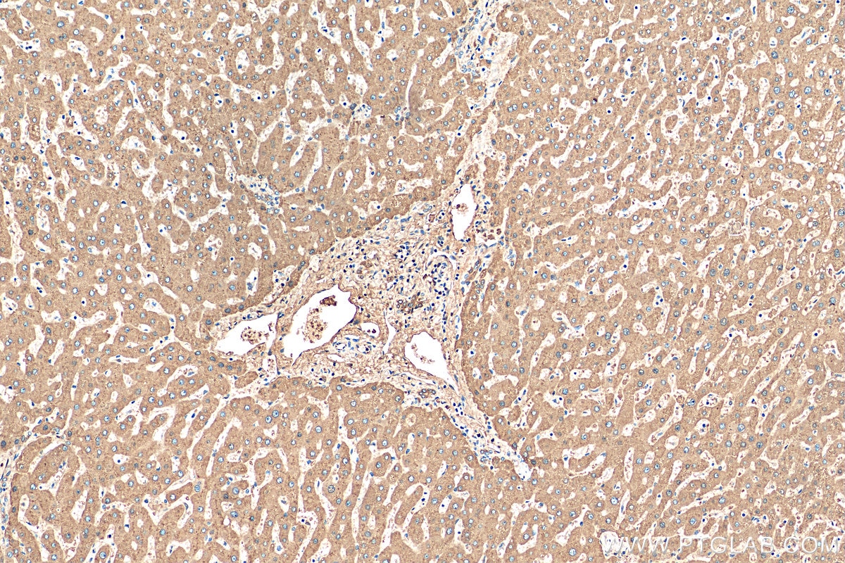 IHC staining of human liver using 16922-1-AP