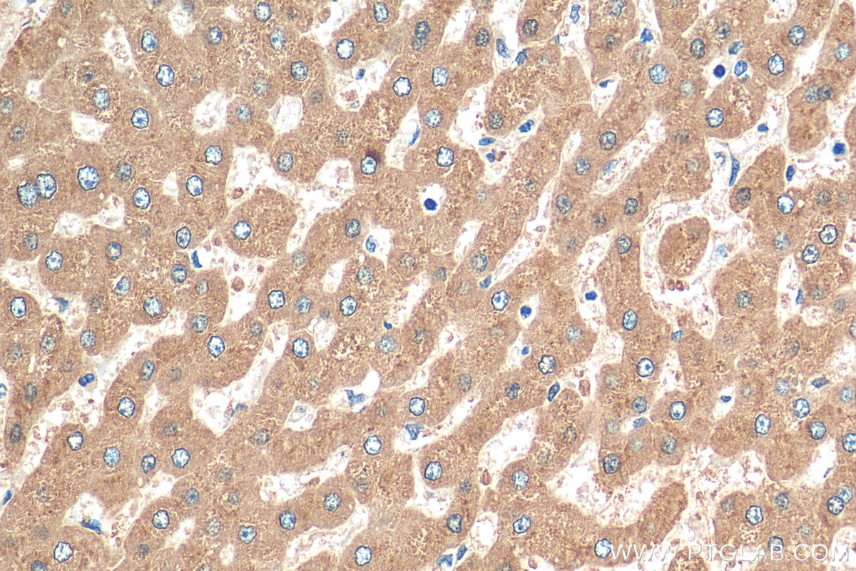Immunohistochemistry (IHC) staining of human liver tissue using Vitamin D binding protein Polyclonal antibody (16922-1-AP)