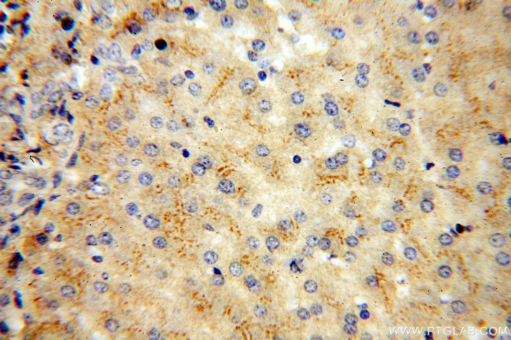 Vitamin D binding protein