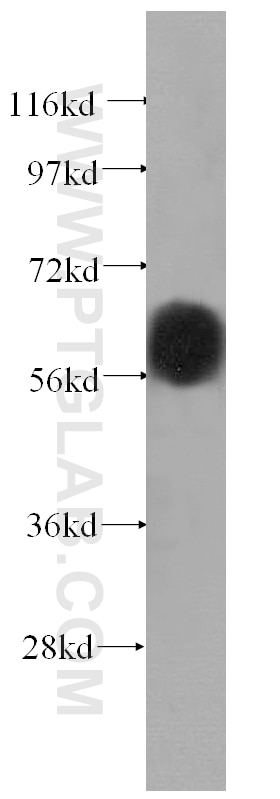 Western Blot (WB) analysis of mouse eye tissue using Vitamin D binding protein Polyclonal antibody (16922-1-AP)