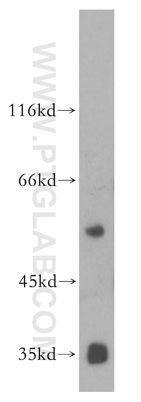 Western Blot (WB) analysis of PC-3 cells using Vitamin D binding protein Polyclonal antibody (16922-1-AP)