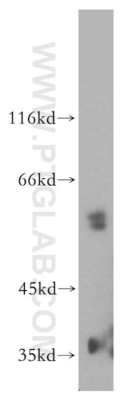 Western Blot (WB) analysis of mouse eye tissue using Vitamin D binding protein Polyclonal antibody (16922-1-AP)