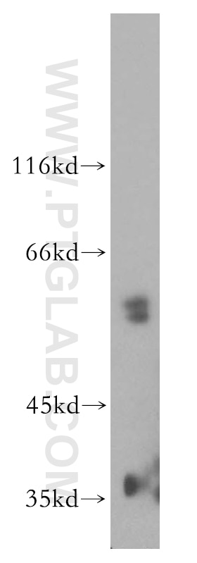 WB analysis of mouse eye using 16922-1-AP