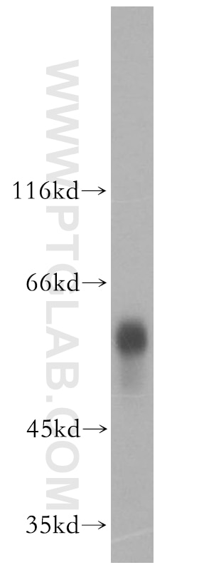 Western Blot (WB) analysis of human plasma using Vitamin D binding protein Polyclonal antibody (16922-1-AP)