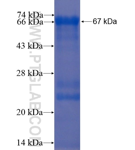 VDBP,GC fusion protein Ag10286 SDS-PAGE