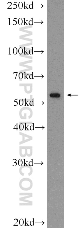 Western Blot (WB) analysis of PC-3 cells using VDR Polyclonal antibody (14526-1-AP)