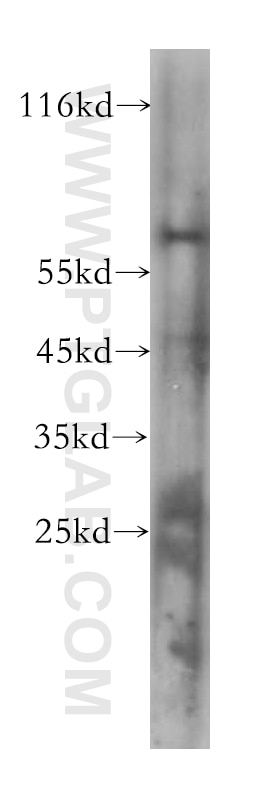 Western Blot (WB) analysis of HeLa cells using VDR Monoclonal antibody (60116-1-Ig)