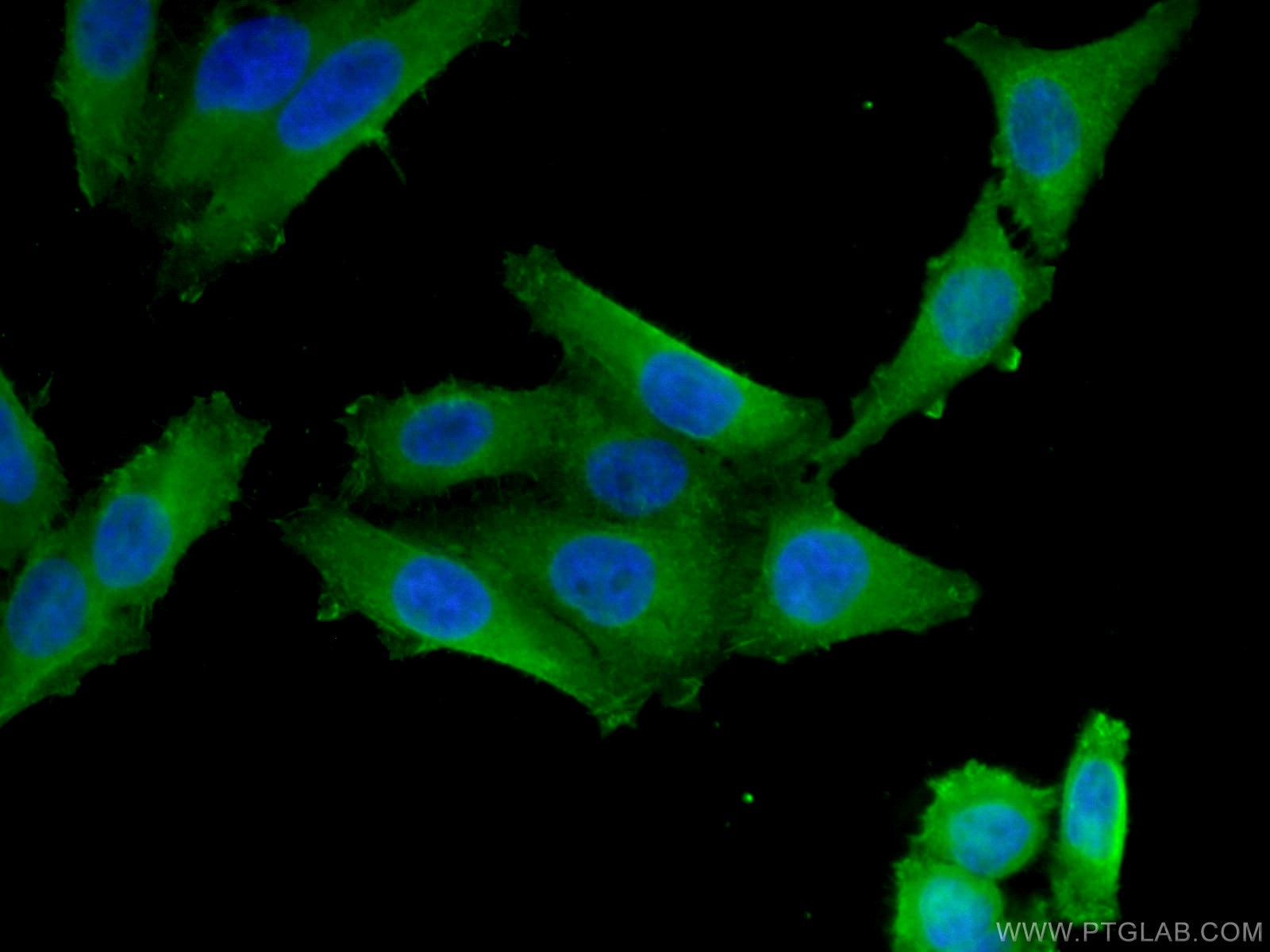 Immunofluorescence (IF) / fluorescent staining of HepG2 cells using VDR Monoclonal antibody (67192-1-Ig)