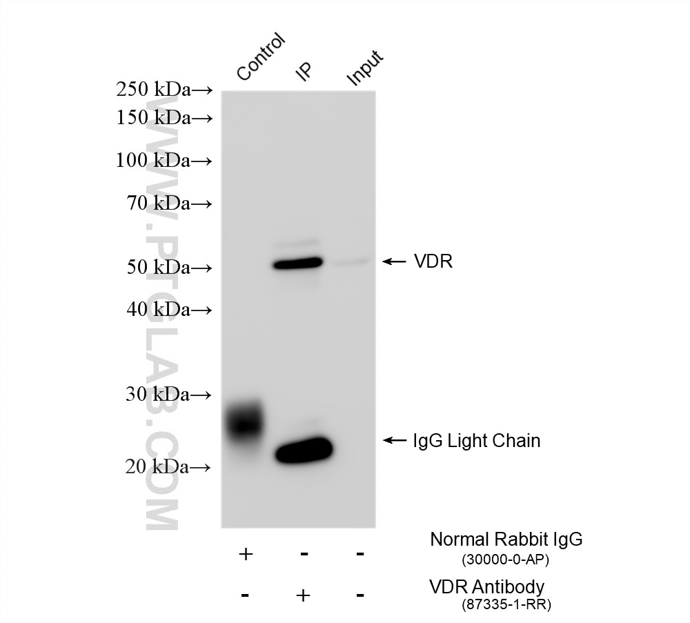 IP result of anti-VDR (IP:87335-1-RR, 4ug; Detection:87335-1-RR 1:1500) with HeLa cells lysate 1320 ug. This data was developed using the same antibody clone with 87335-1-PBS in a different storage buffer formulation. Immunoprecipitation (IP) experiment of HeLa cells using VDR Recombinant monoclonal antibody (87335-1-RR)