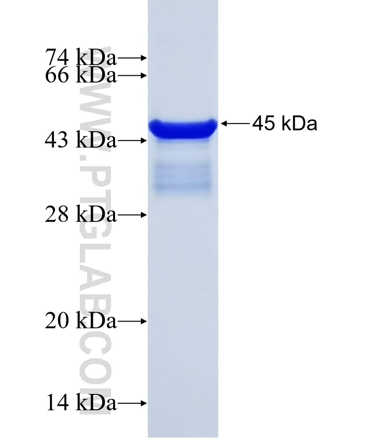 VDR fusion protein Ag28176 SDS-PAGE