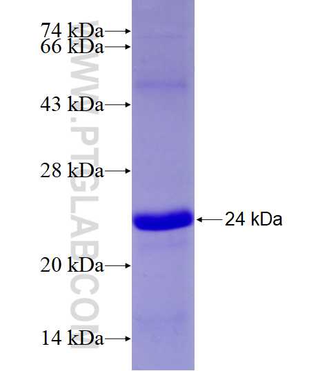 VDR fusion protein Ag28188 SDS-PAGE