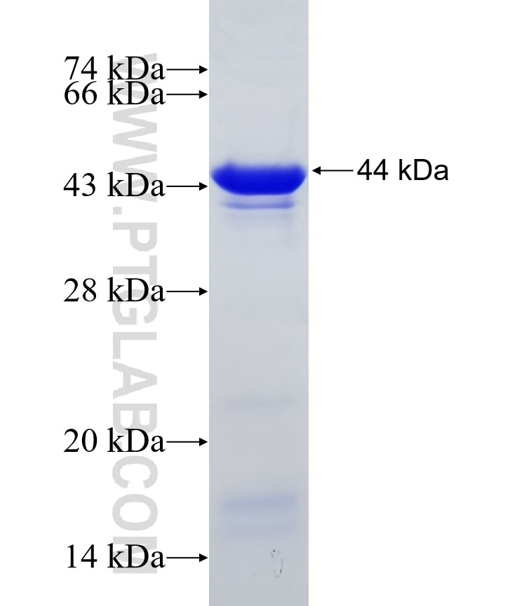 VDR fusion protein Ag6012 SDS-PAGE