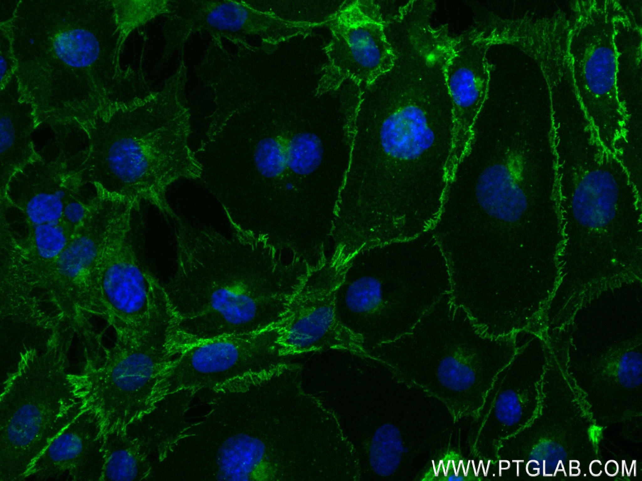Immunofluorescence (IF) / fluorescent staining of HUVEC cells using VE-cadherin Recombinant antibody (83766-2-RR)