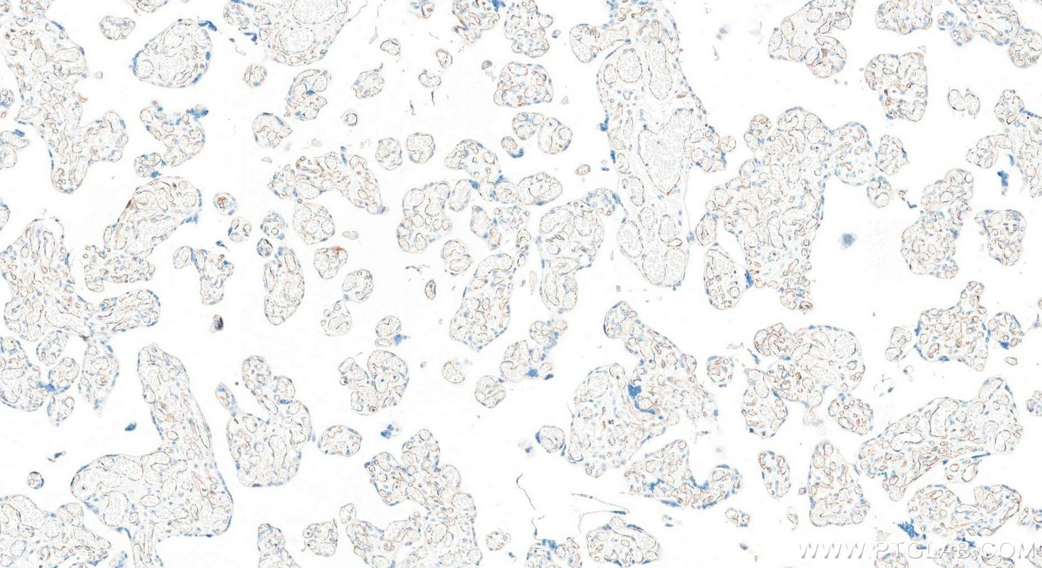 Immunohistochemistry (IHC) staining of human placenta tissue using VE-cadherin/CD144 Recombinant monoclonal antibody (83766-5-RR)