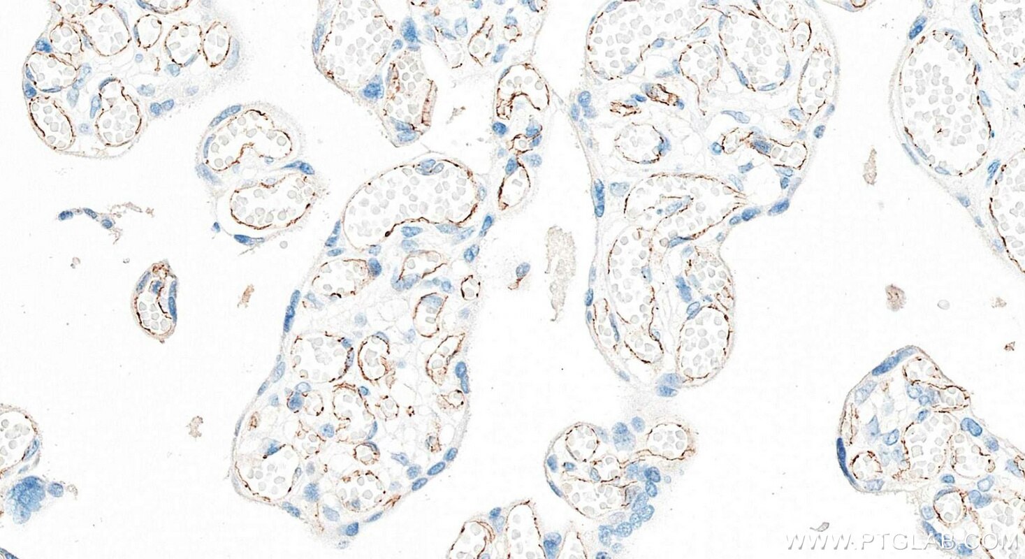Immunohistochemistry (IHC) staining of human placenta tissue using VE-cadherin/CD144 Recombinant monoclonal antibody (83766-5-RR)