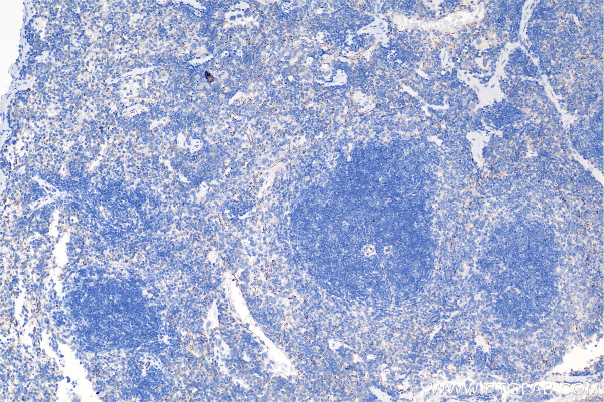 Immunohistochemistry (IHC) staining of mouse spleen tissue using VE-cadherin/CD144 Recombinant antibody (84529-3-RR)