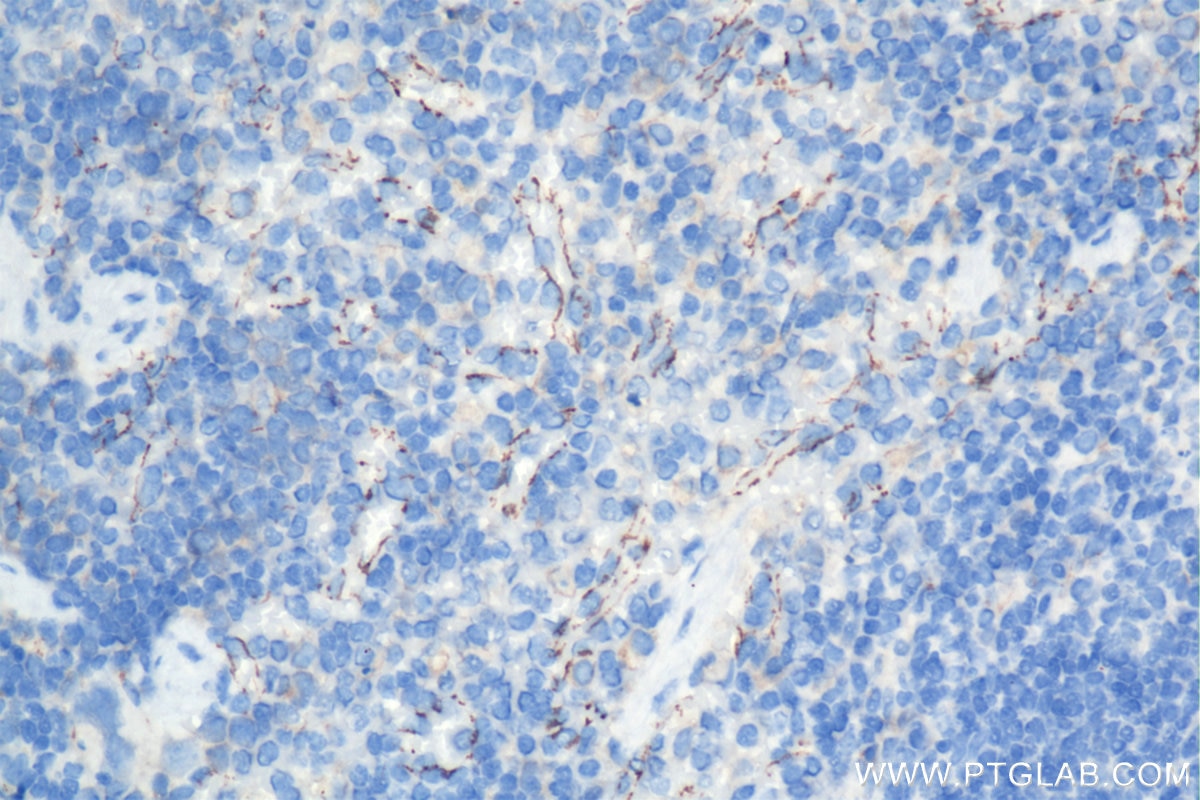 Immunohistochemistry (IHC) staining of mouse spleen tissue using VE-cadherin/CD144 Recombinant antibody (84529-3-RR)