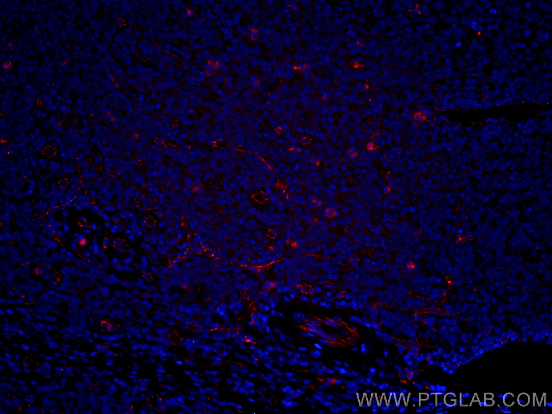 Immunofluorescence (IF) / fluorescent staining of human tonsillitis tissue using CoraLite®594-conjugated VE-cadherin Monoclonal ant (CL594-66804)