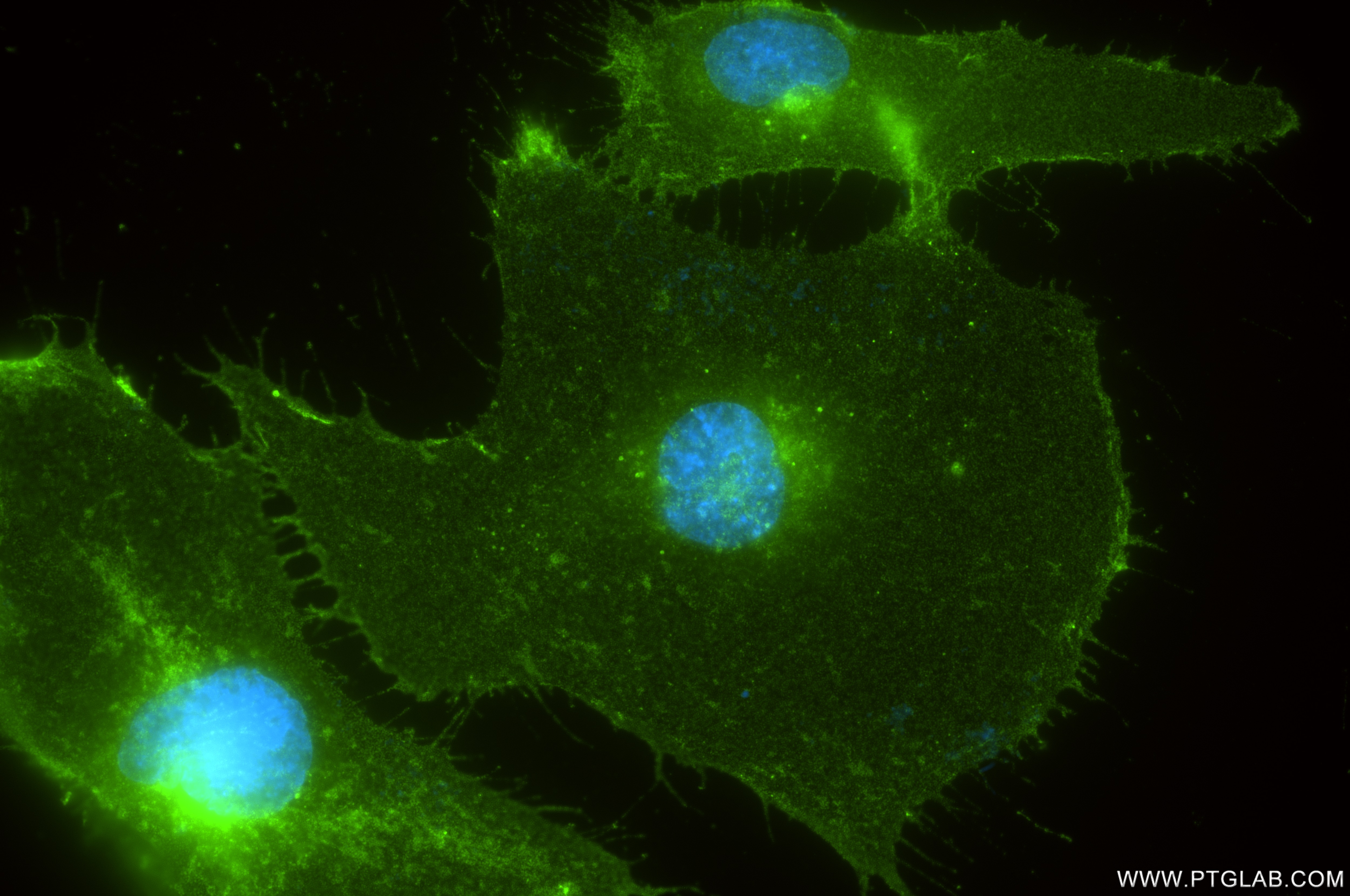 Immunofluorescence (IF) / fluorescent staining of HUVEC cells using VE-cadherin/CD144 Recombinant antibody (83766-6-RR)