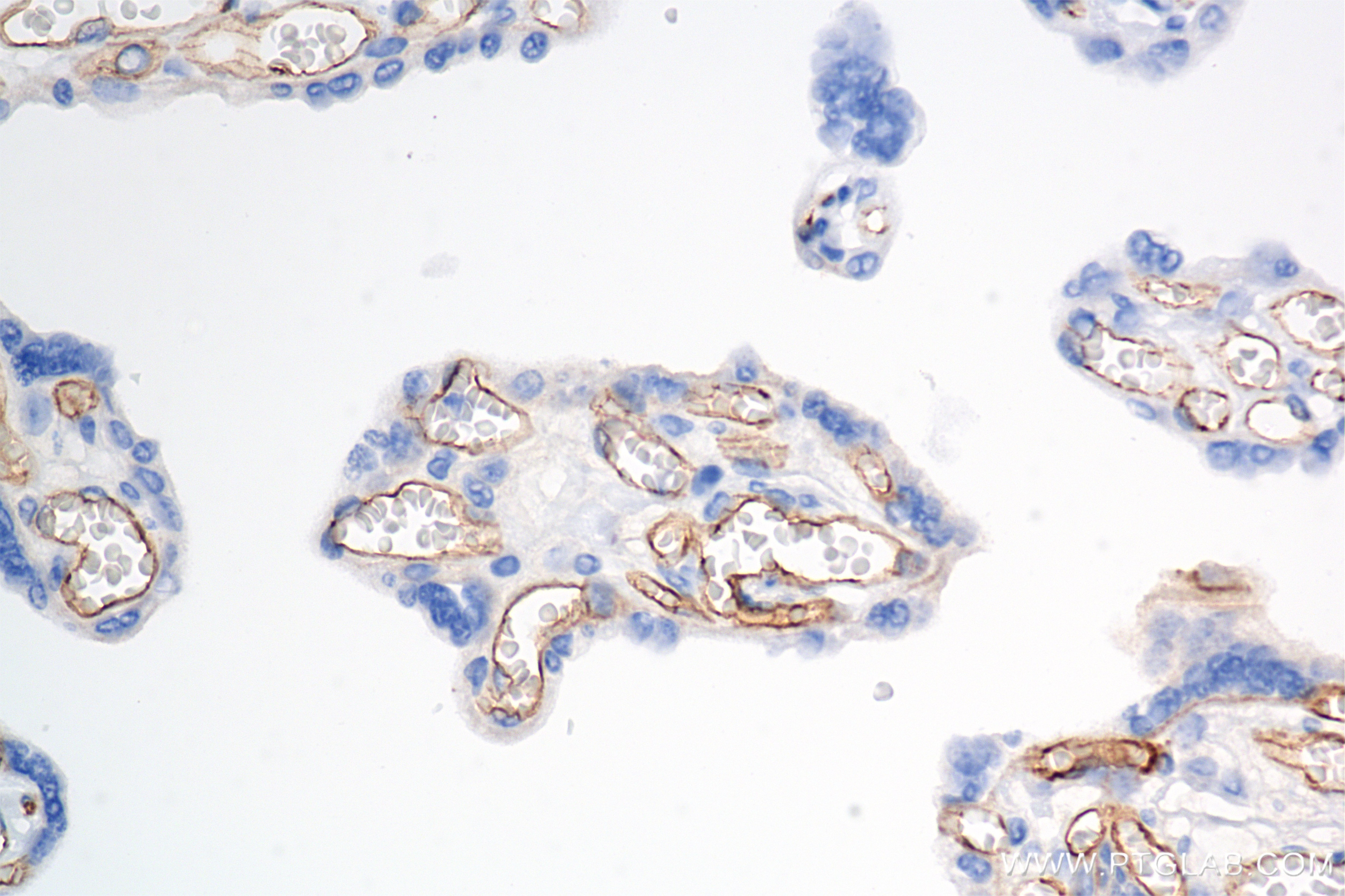 Immunohistochemistry (IHC) staining of human placenta tissue using VE-cadherin/CD144 Recombinant antibody (83766-6-RR)