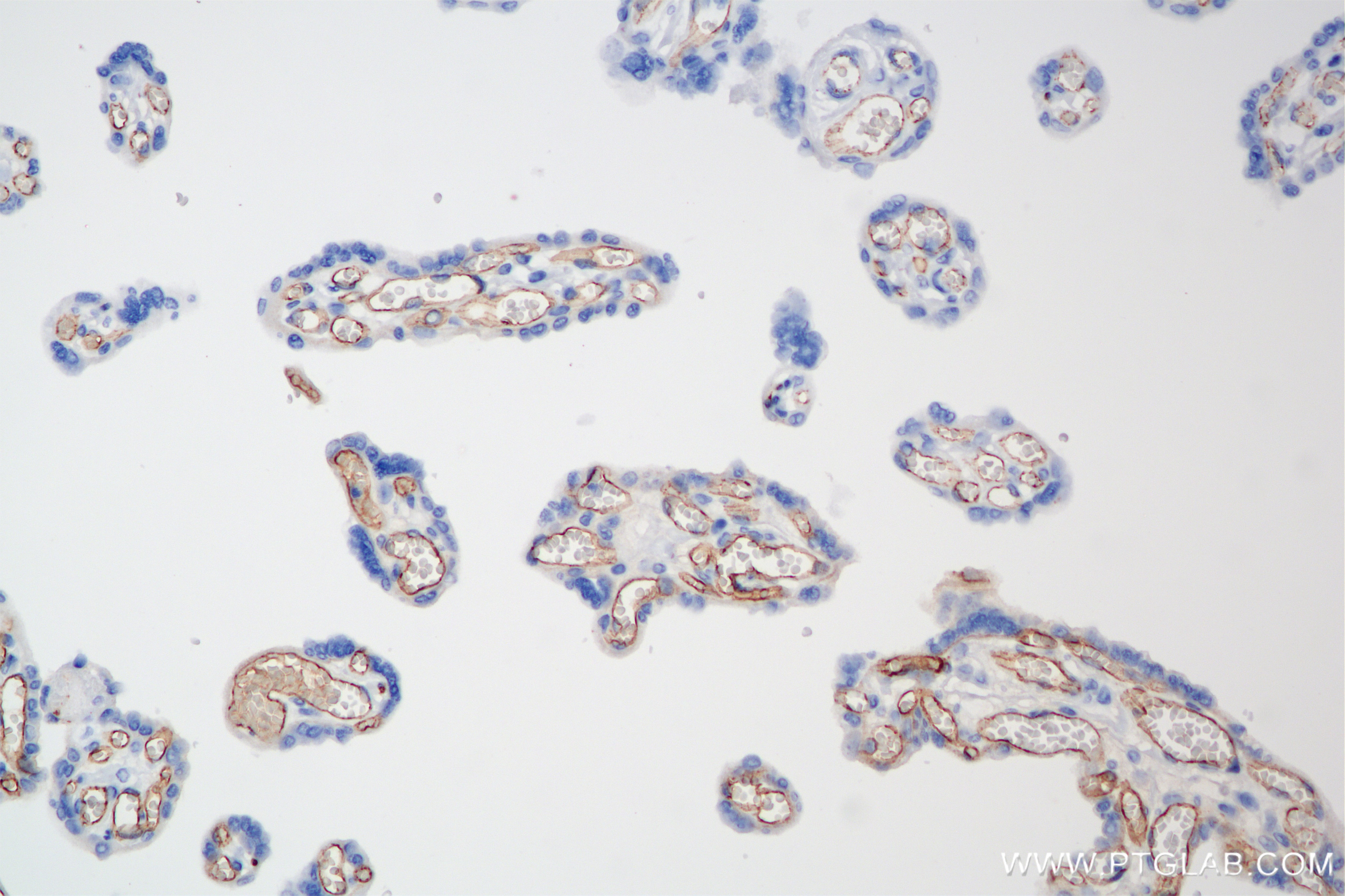 Immunohistochemistry (IHC) staining of human placenta tissue using VE-cadherin/CD144 Recombinant antibody (83766-6-RR)
