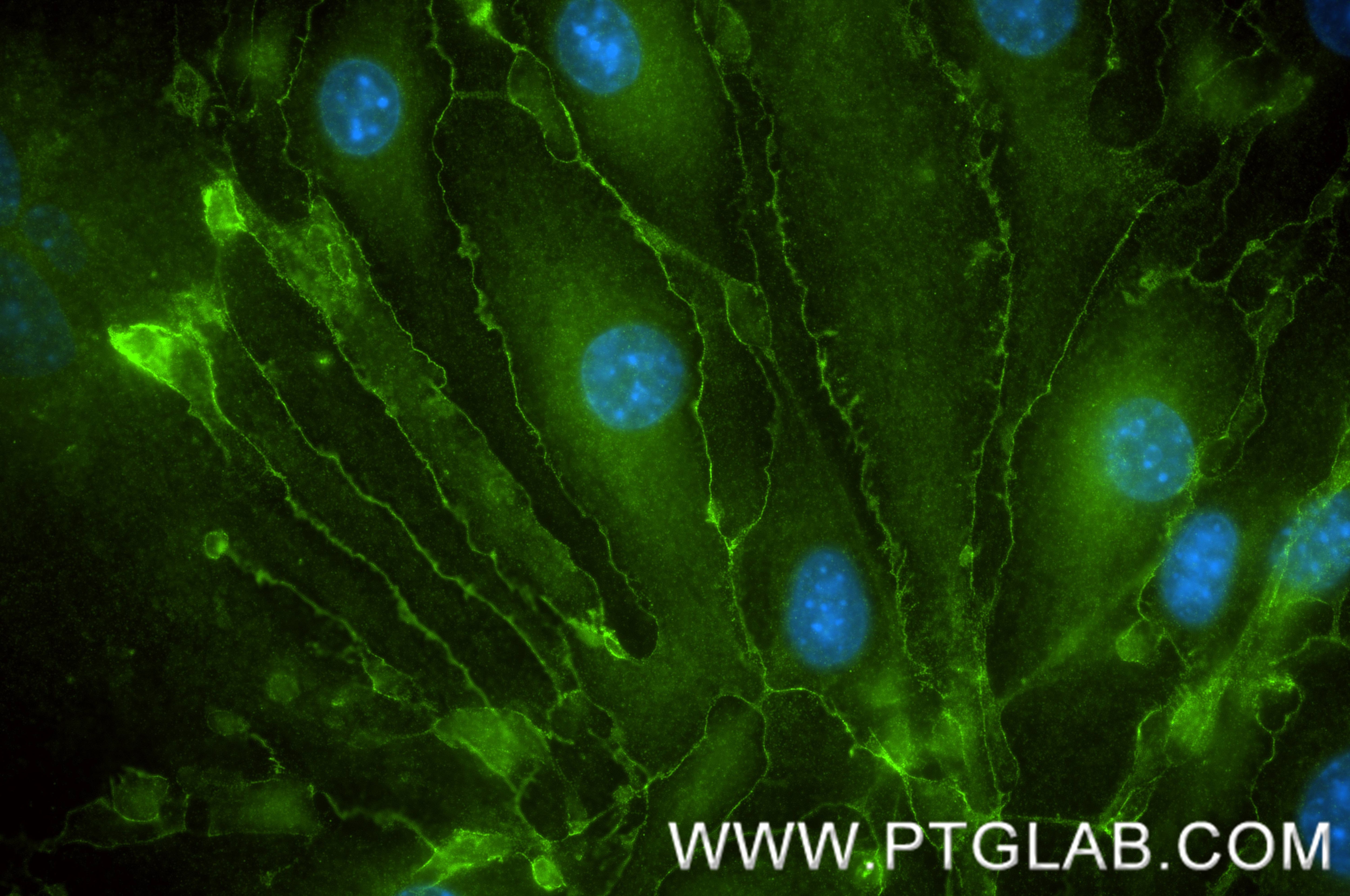 Immunofluorescent analysis of (-20°C Methanol) fixed bEnd.3 cells using VE-cadherin/CD144 antibody (84529-4-RR, Clone: 241953A12 ) at dilution of 1:200 and CoraLite®488-Conjugated Goat Anti-Rabbit IgG(H+L) (SA00013-2). Immunofluorescence (IF) / fluorescent staining of bEnd.3 cells using VE-cadherin/CD144 Recombinant monoclonal antibody (84529-4-RR)