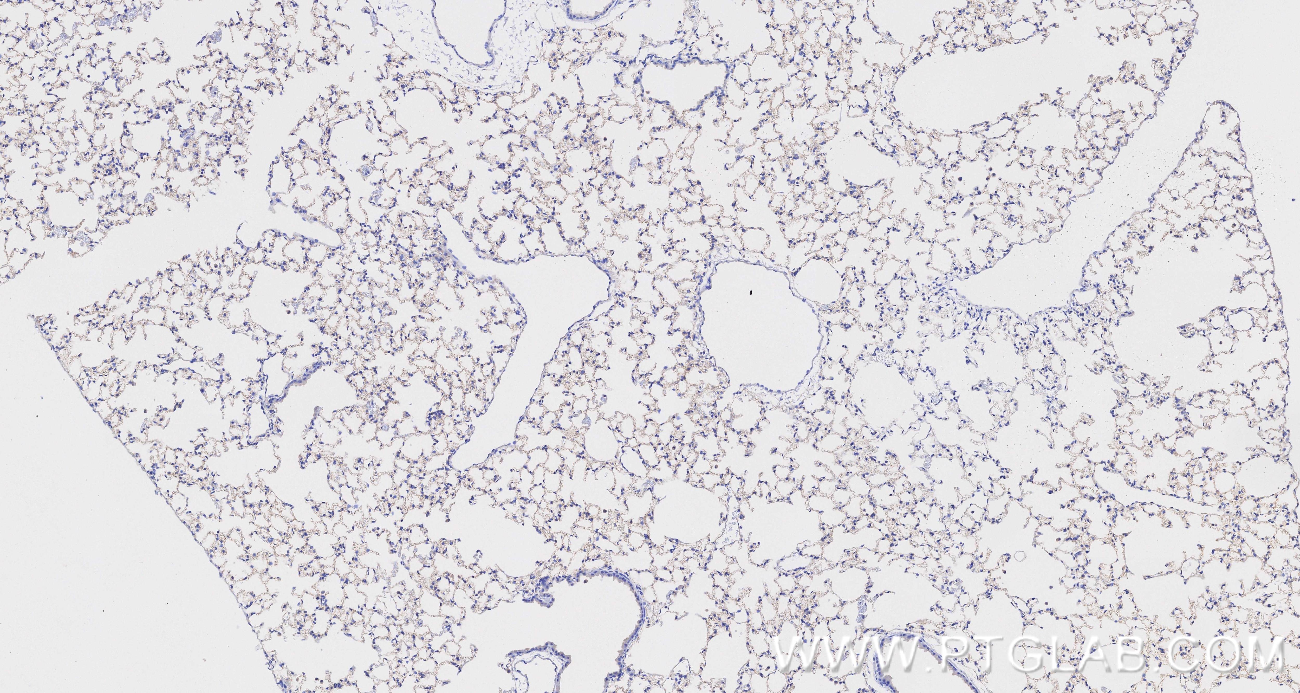 IHC staining of mouse lung using 84529-4-RR Immunohistochemistry (IHC) staining of mouse lung tissue using VE-cadherin/CD144 Recombinant monoclonal antibody (84529-4-RR)