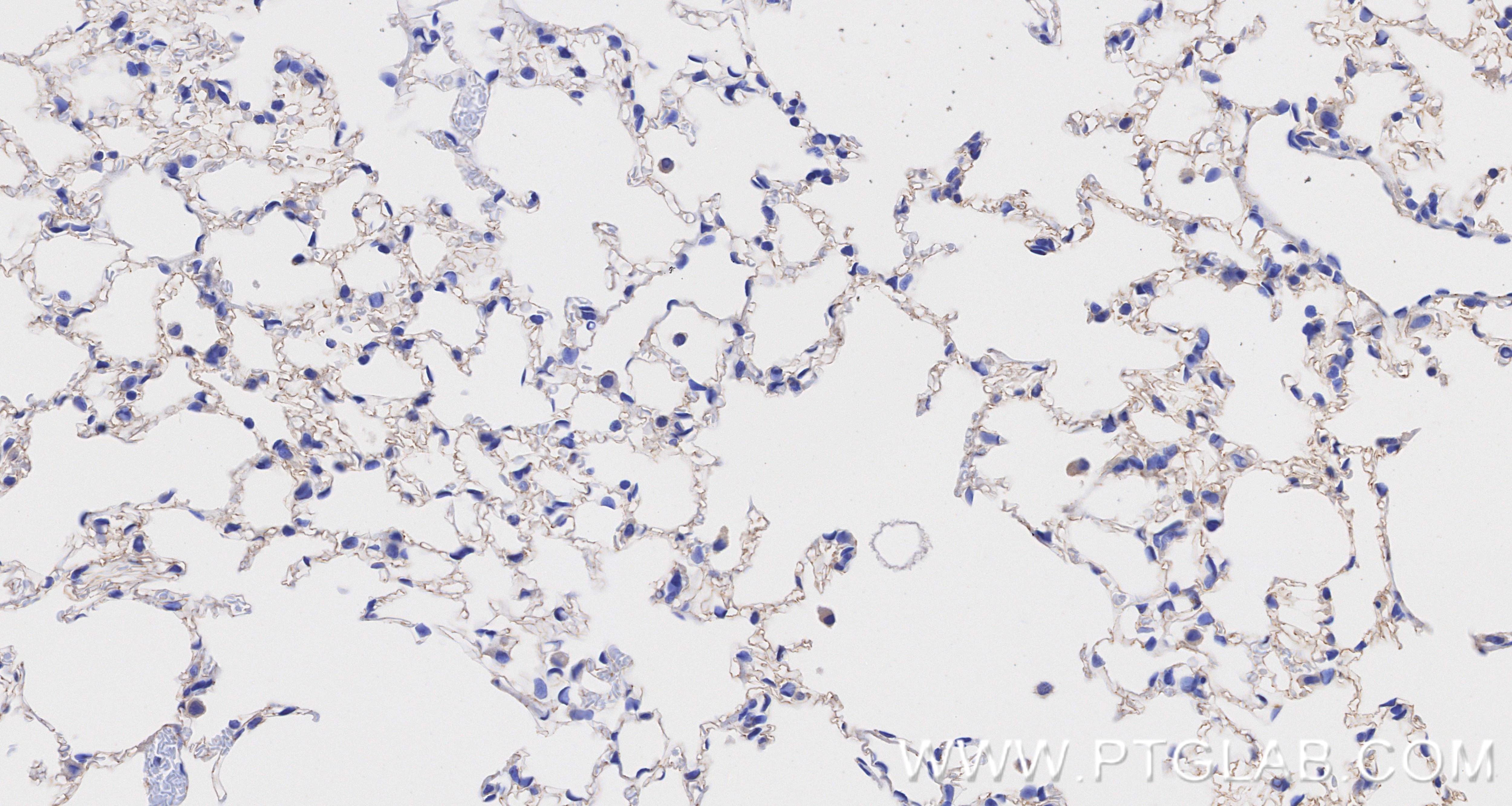 IHC staining of mouse lung using 84529-4-RR Immunohistochemistry (IHC) staining of mouse lung tissue using VE-cadherin/CD144 Recombinant monoclonal antibody (84529-4-RR)