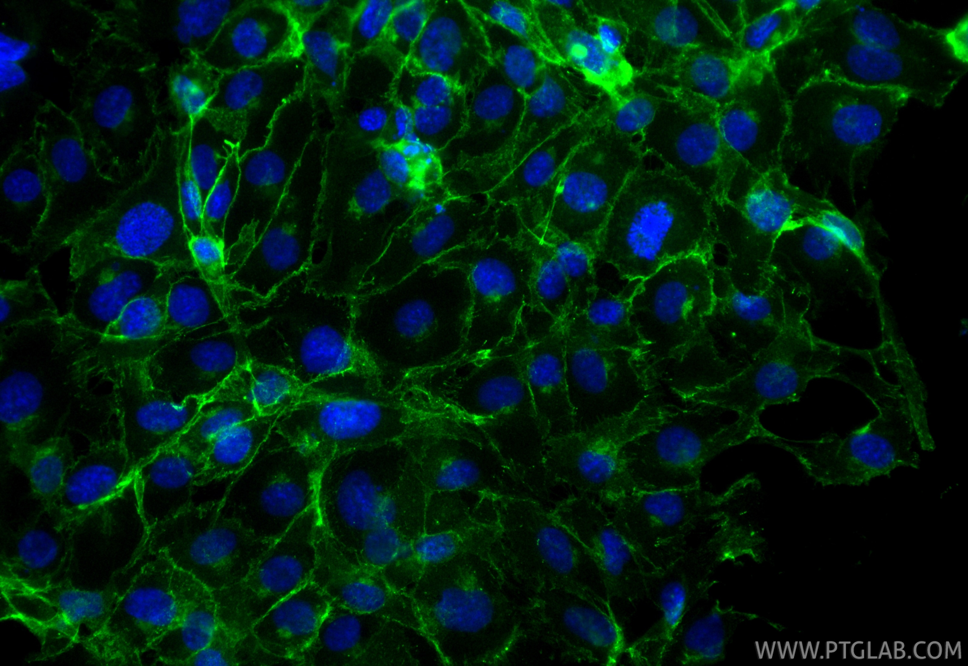 Immunofluorescent analysis of (4% PFA) fixed HUVEC cells using CoraLite® Plus 488 VE-cadherin/CD144 antibody (CL488-83766-6, Clone: 240755D5 ) at dilution of 1:200. Immunofluorescence (IF) / fluorescent staining of HUVEC cells using CoraLite® Plus 488-conjugated VE-cadherin/CD144 Re (CL488-83766-6)