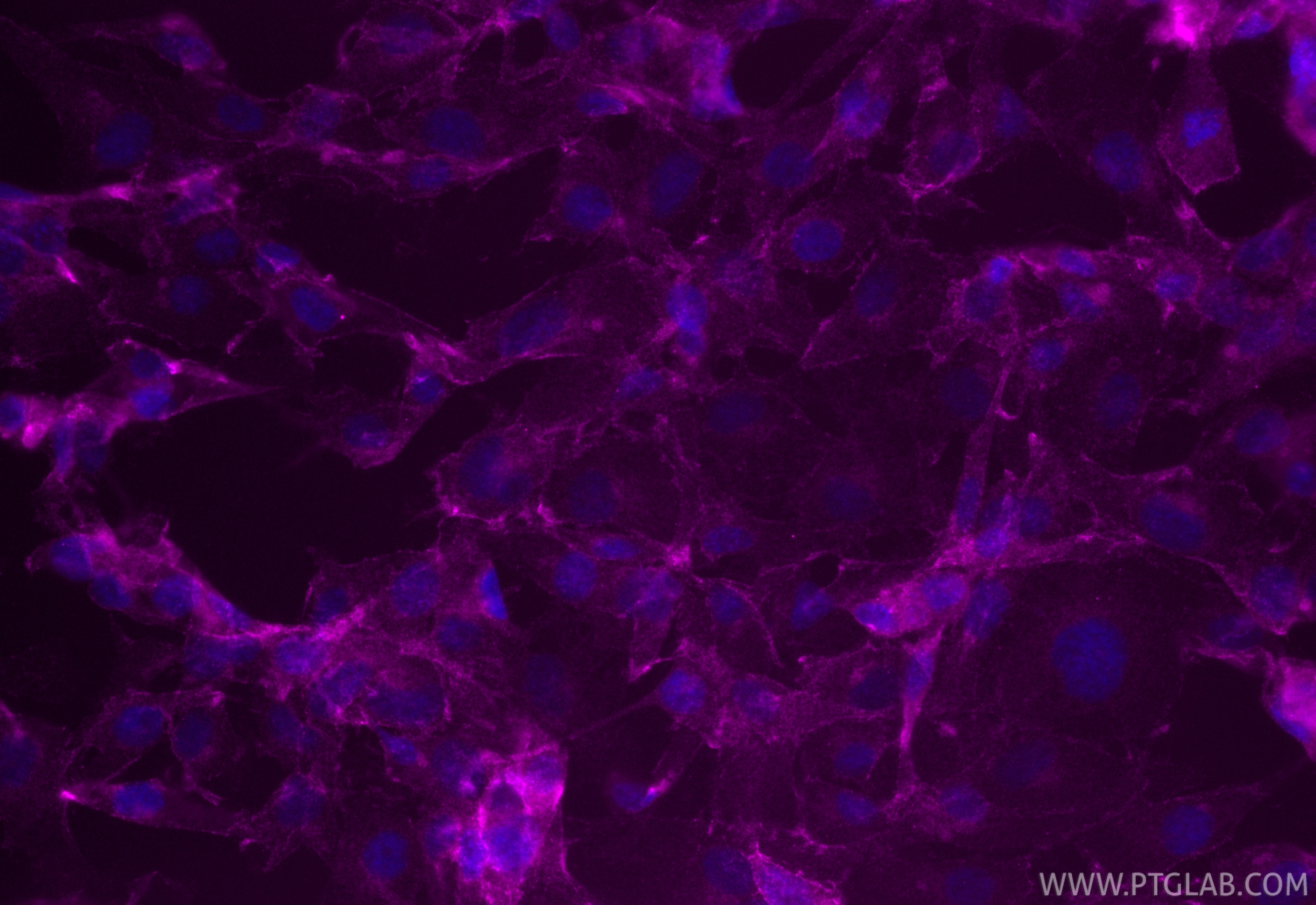 Immunofluorescence (IF) / fluorescent staining of HUVEC cells using CoraLite® Plus 647-conjugated VE-cadherin/CD144 Mo (CL647-66804)