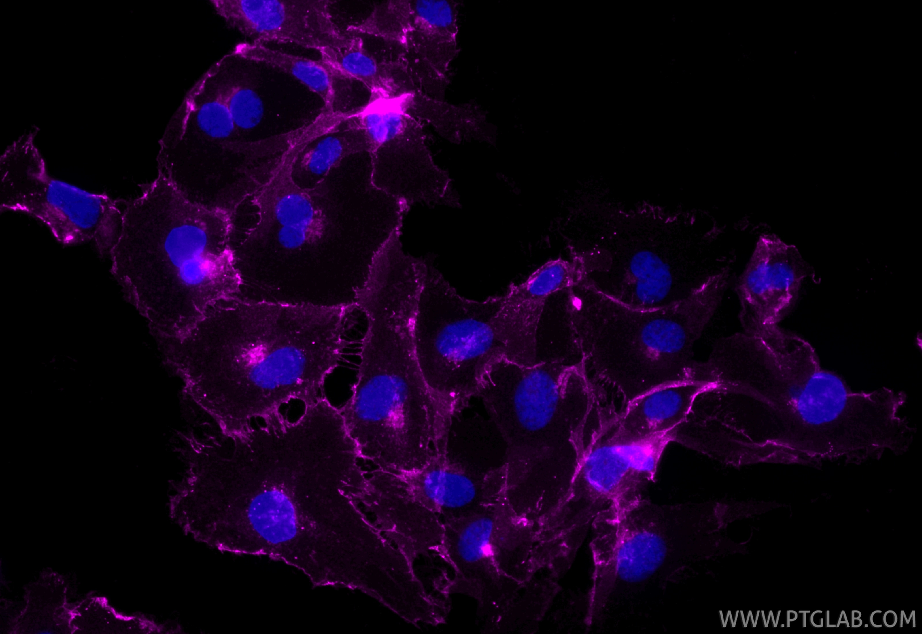 Immunofluorescent analysis of (4% PFA) fixed HUVEC cells using CoraLite® Plus 647 VE-cadherin/CD144 antibody (CL647-83766-6, Clone: 240755D5 ) at dilution of 1:200. Immunofluorescence (IF) / fluorescent staining of HUVEC cells using CoraLite® Plus 647-conjugated VE-cadherin/CD144 Re (CL647-83766-6)