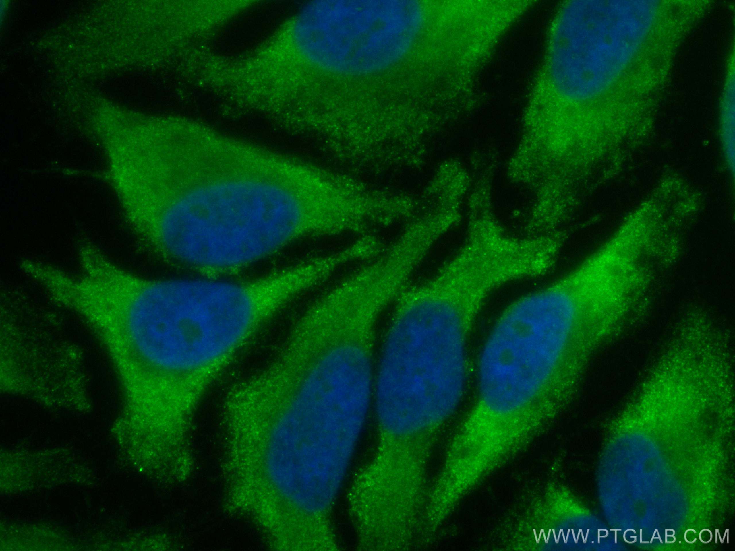 Immunofluorescence (IF) / fluorescent staining of HeLa cells using CoraLite® Plus 488-conjugated VEGFA Polyclonal ant (CL488-19003)