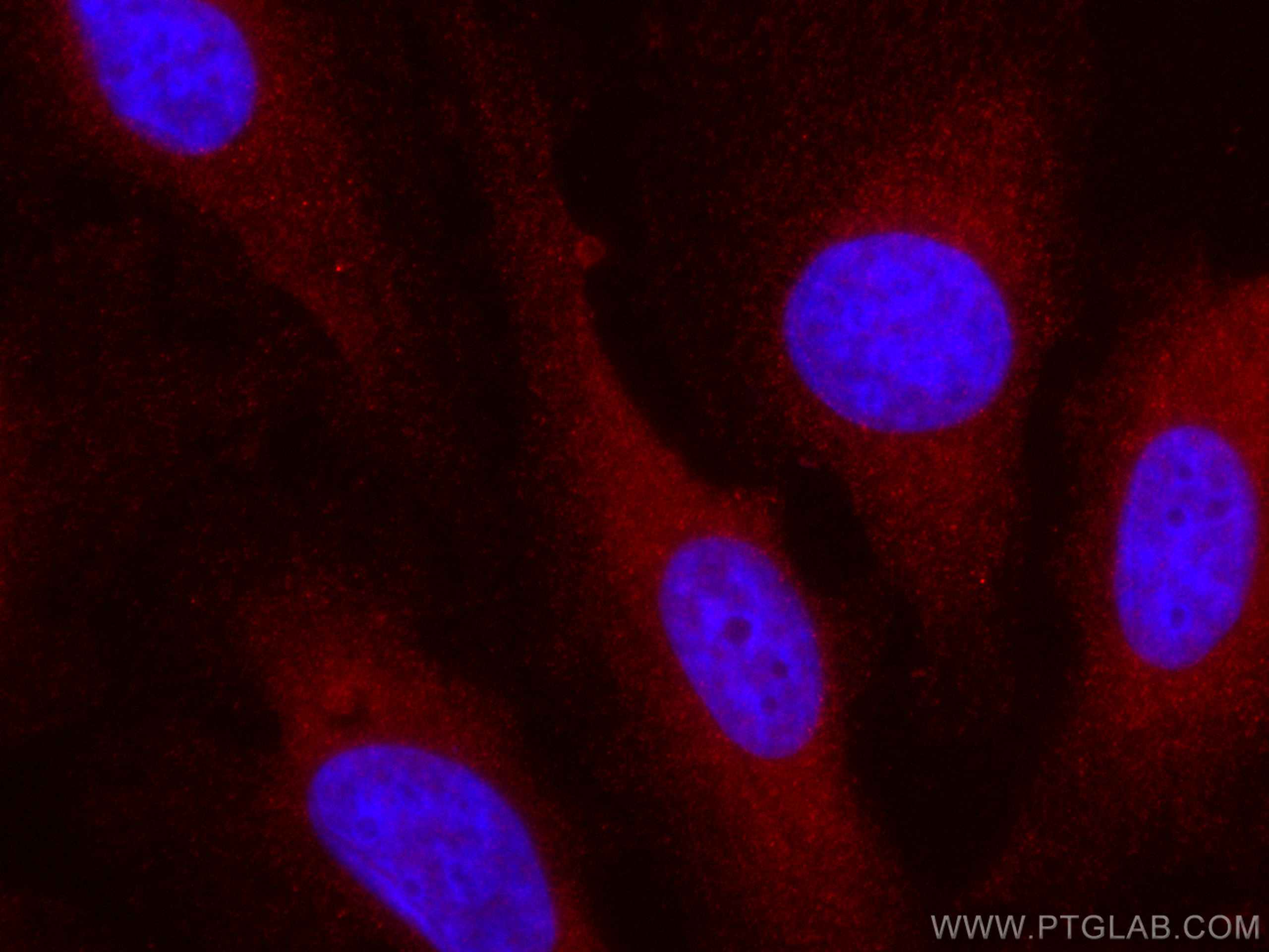 Immunofluorescence (IF) / fluorescent staining of HeLa cells using CoraLite®594-conjugated VEGFA Polyclonal antibody (CL594-19003)