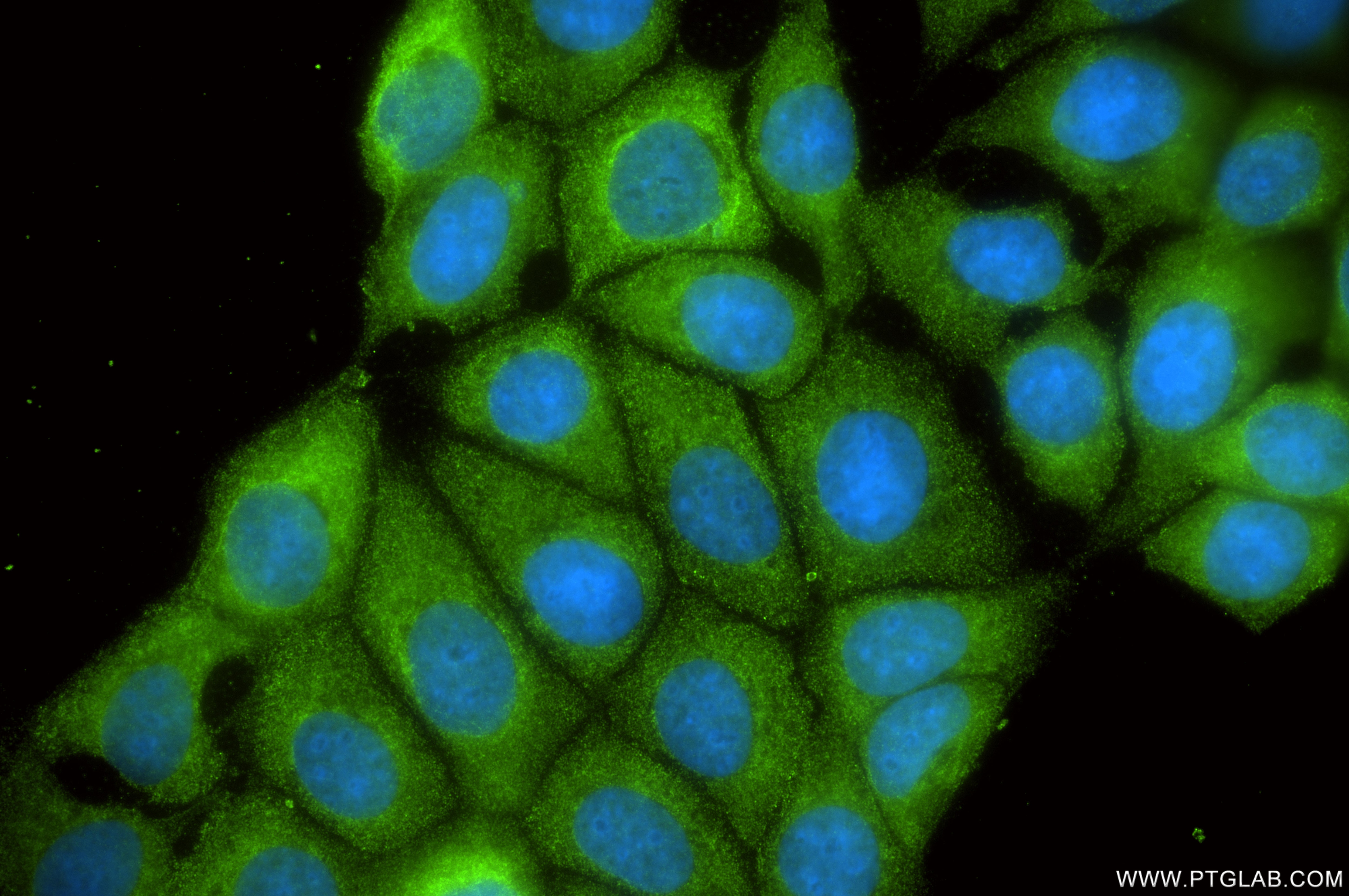 Immunofluorescence (IF) / fluorescent staining of MCF-7 cells using VEGF-C Recombinant monoclonal antibody (83727-7-RR)