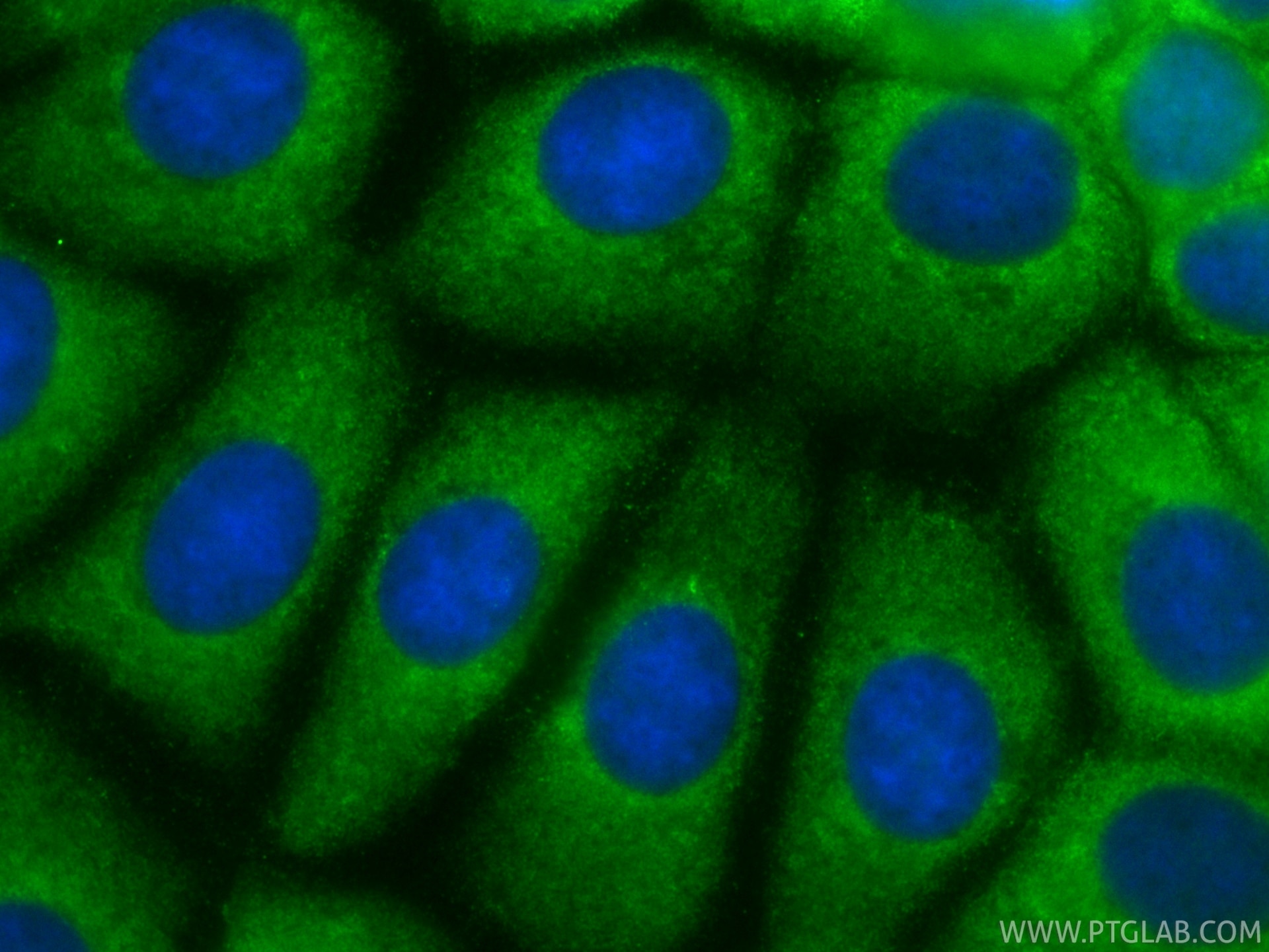 Immunofluorescence (IF) / fluorescent staining of MCF-7 cells using CoraLite® Plus 488-conjugated VEGF-C Recombinant m (CL488-83727-7)